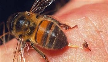 LƯU Ý: Cách sơ cấp cứu khi trẻ bị ong đốt