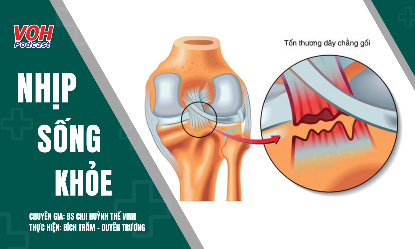 Chấn thương dây chằng: Nguyên nhân và biến chứng