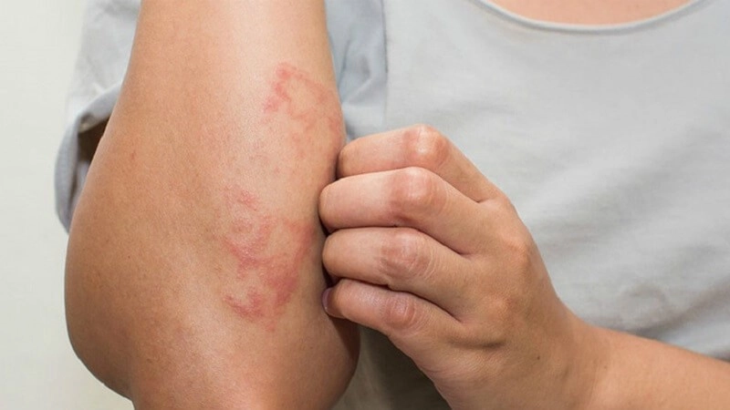 Những dấu hiệu cảnh báo gan có thể bị nhiễm độc