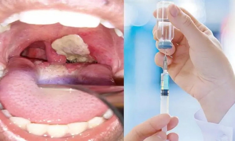Người dân không tự ý tiêm vaccine chứa thành bạch hầu khi chưa có khuyến cáo