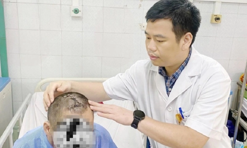 Cứu sống người đàn ông bị trầm cảm, tự đóng đinh vào đầu