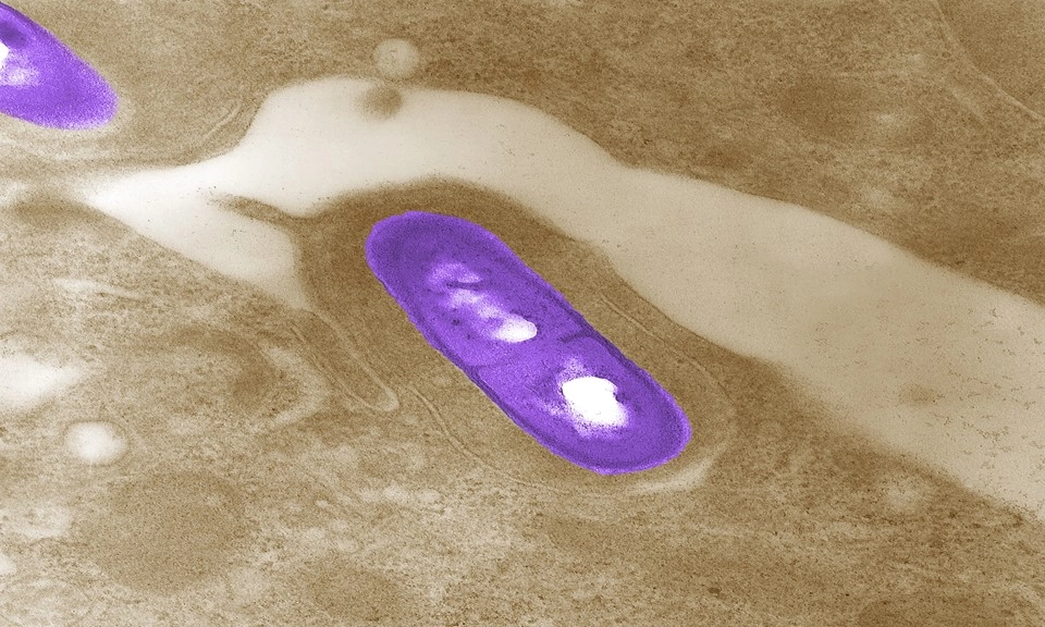 Mỹ: Đợt bùng phát vi khuẩn Listeria liên quan đến thịt nguội khiến 5 người thiệt mạng