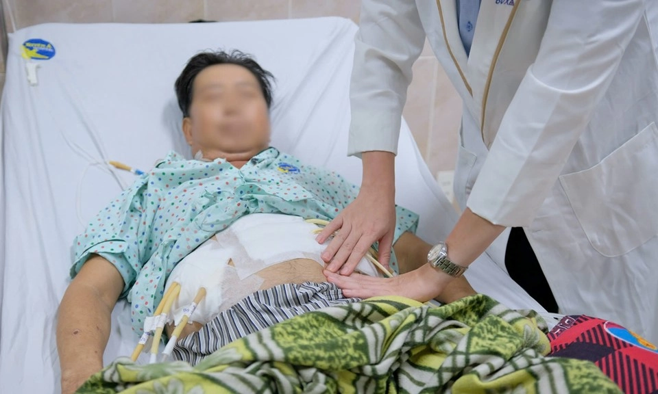 Người đàn ông bị thủng dạ dày vì lạm dụng thuốc giảm đau