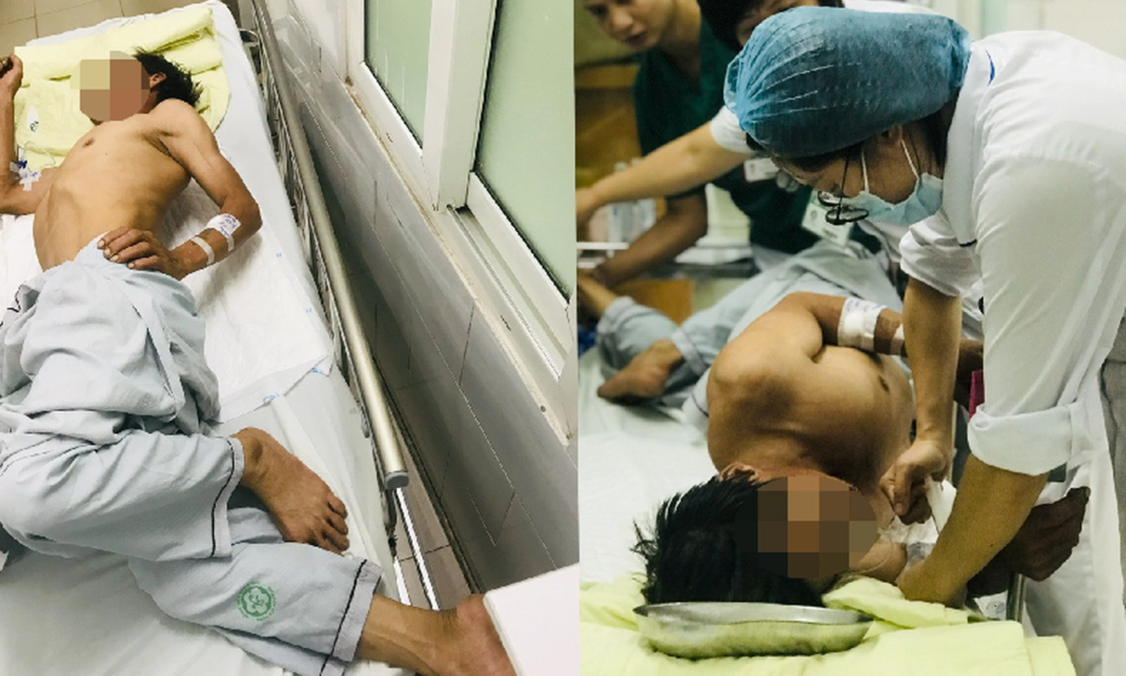 Đạp đinh nhưng không tiêm ngừa, người đàn ông phải cấp cứu do uốn ván