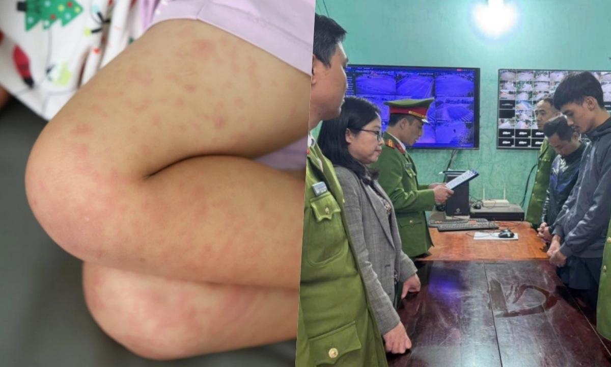 Điểm tin trưa 28/12: Số ca sởi tại TPHCM tiếp tục tăng | Giả phóng viên để lừa “chạy án 