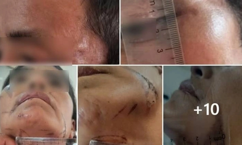 Điện Biên điều tra vụ bắt giữ người trái pháp luật vì nghi bỏ bùa