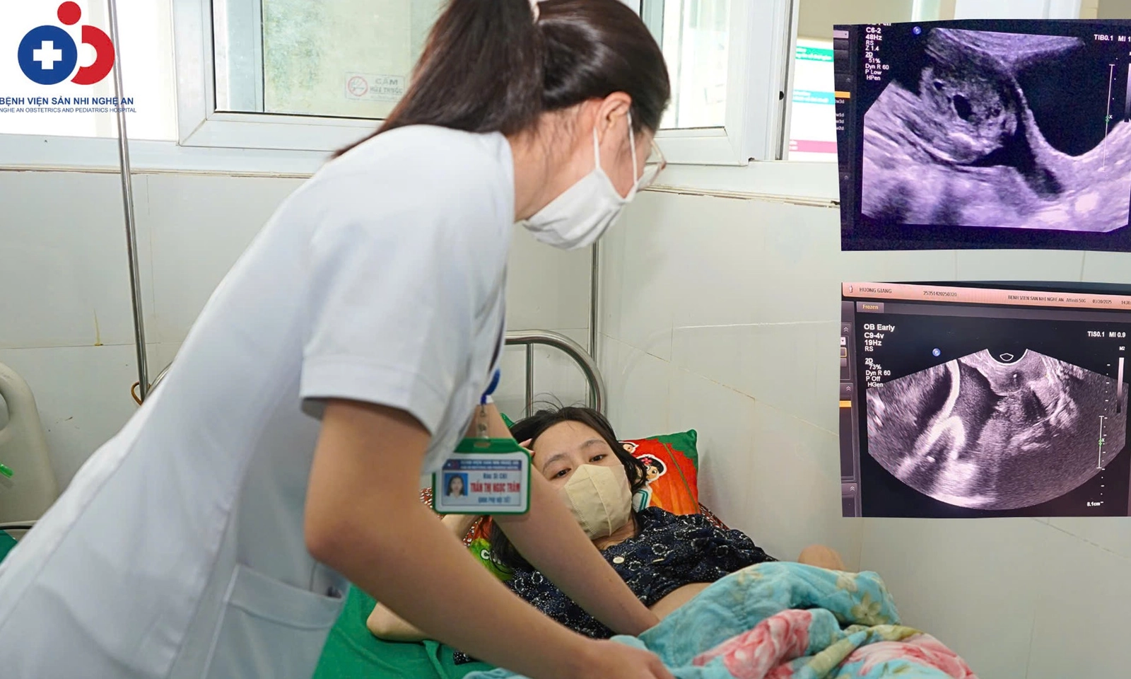 Kịp thời khâu eo tử cung, cứu thai nhi 22 tuần