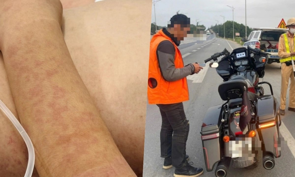 Điểm tin trưa 27/3: Ca mắc sởi giảm nhanh | Xử lý nhóm lái xe phân khối lớn náo loạn QL1