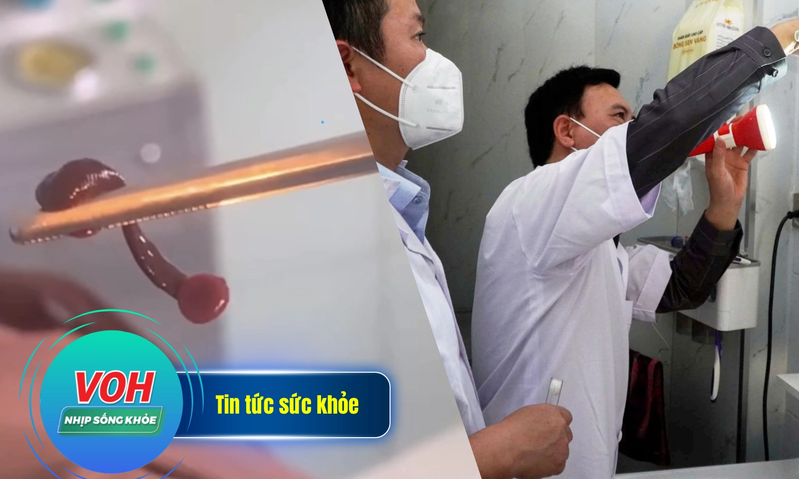 Nhịp sống khỏe 29/3: Vắt kí sinh trong mũi người đàn ông | Hà Tĩnh xuất hiện ca sốt rét ngoại lai