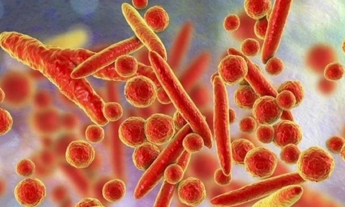 WHO bác bỏ thông tin về virus lạ gây ho ra máu ở Nga, xác nhận nhiễm vi khuẩn MP