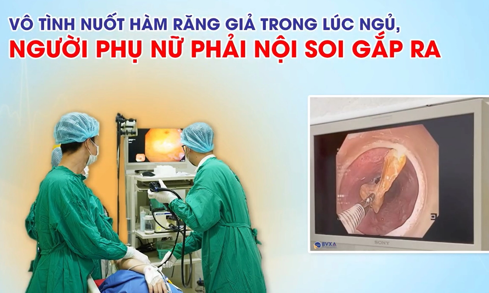 Người phụ nữ vô tình nuốt hàm răng giả trong lúc ngủ