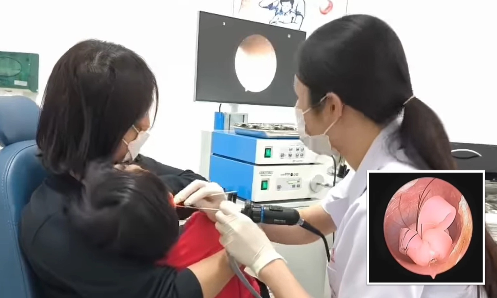 Dây thun buộc tóc mắc kẹt trong tai bé gái 2 tuổi