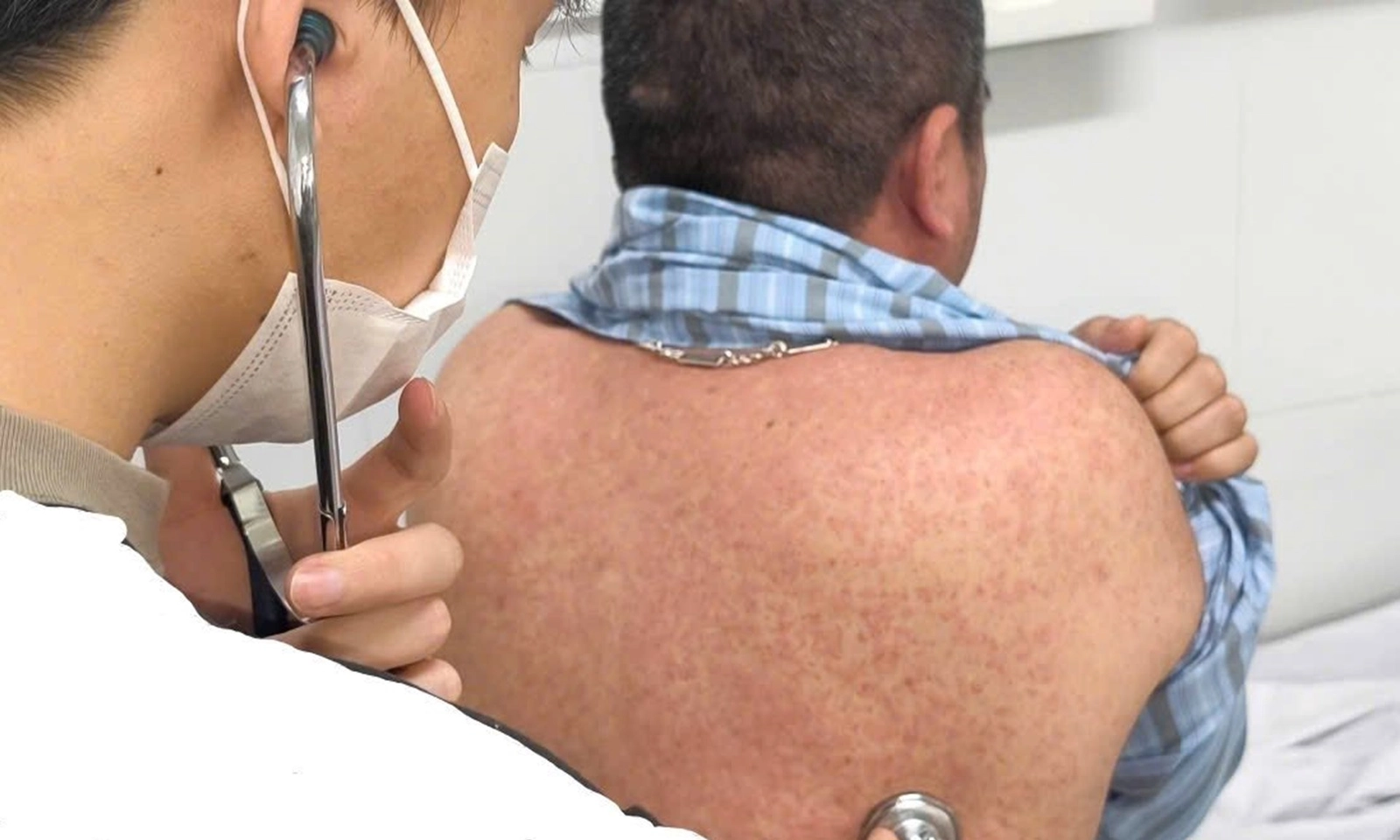 Bác sĩ cảnh báo: Người lớn mắc sởi cũng dễ gặp biến chứng nặng