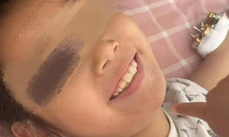 Bé gái 9 tuổi sống sót kỳ diệu sau khi rơi từ tầng 25