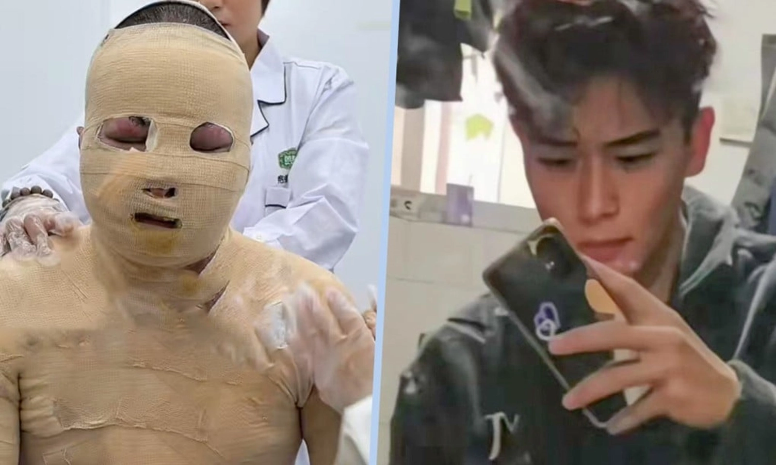 Nổ pin xe đạp điện nhưng bạn cùng phòng đóng cửa bỏ chạy, nam thanh niên mắc kẹt bị bỏng 90%