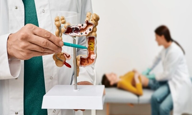 Phát hiện mới: Nhiễm E. coli từ nhỏ có thể làm tăng nguy cơ ung thư đại trực tràng ở người trẻ