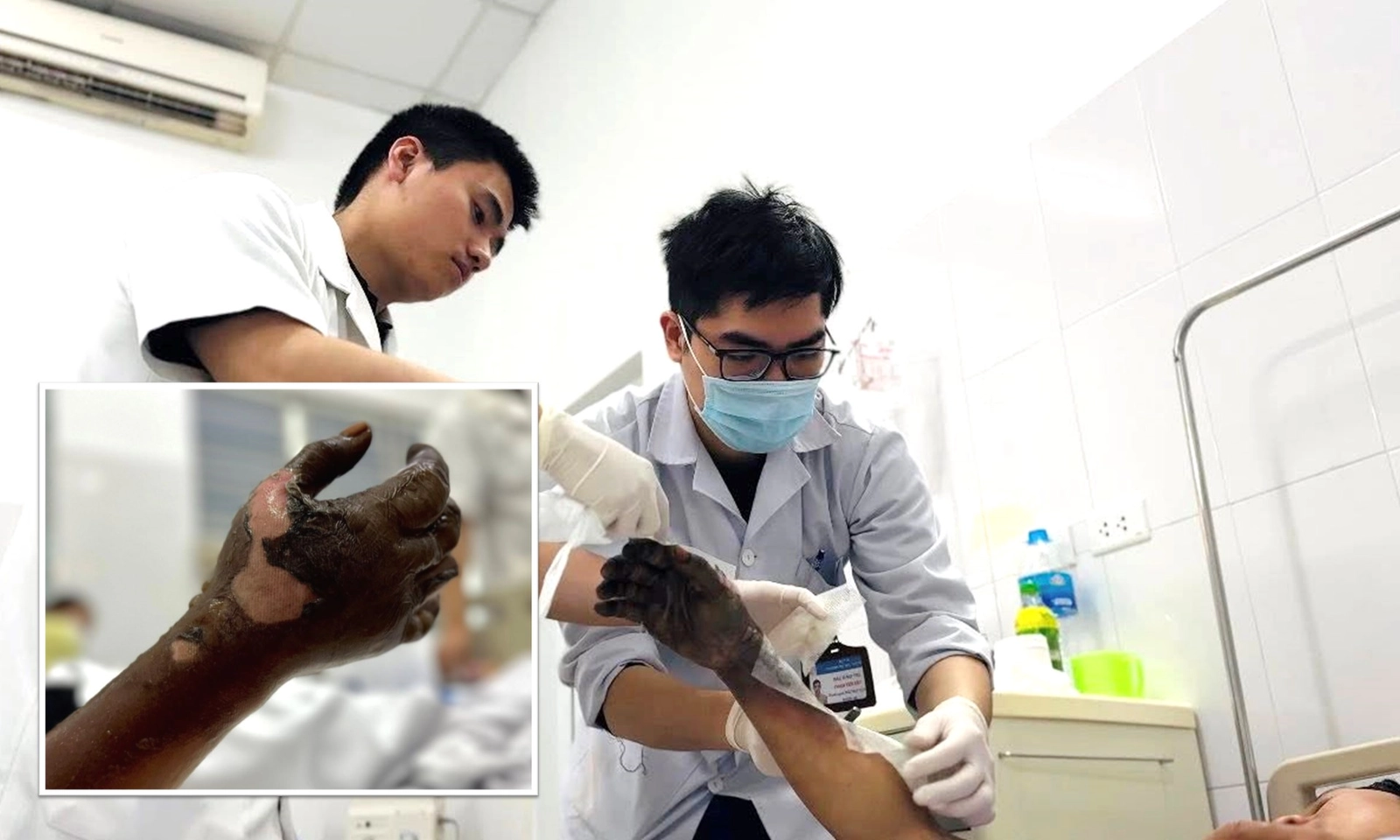 Thợ điện thoát chết thần kỳ sau khi bị điện giật