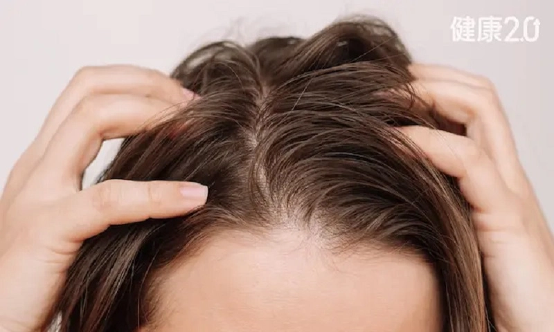 Ăn gì để giúp cải thiện tình trạng tóc dầu nhờn?