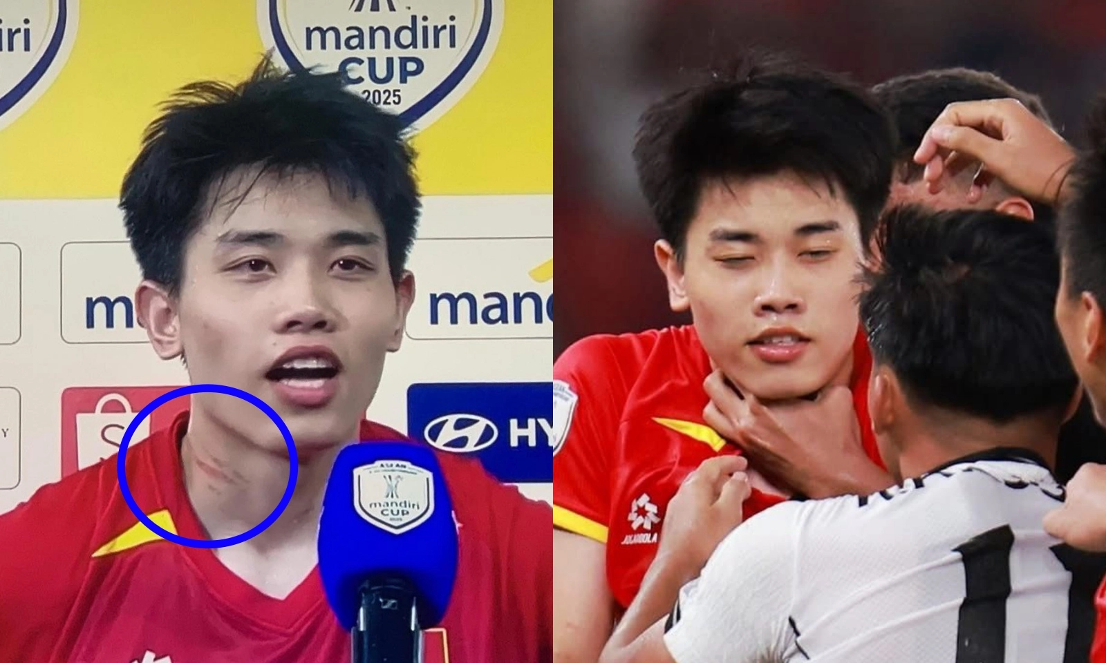 Thương tích xót xa của Đình Bắc sau màn khổ chiến với U23 Indonesia