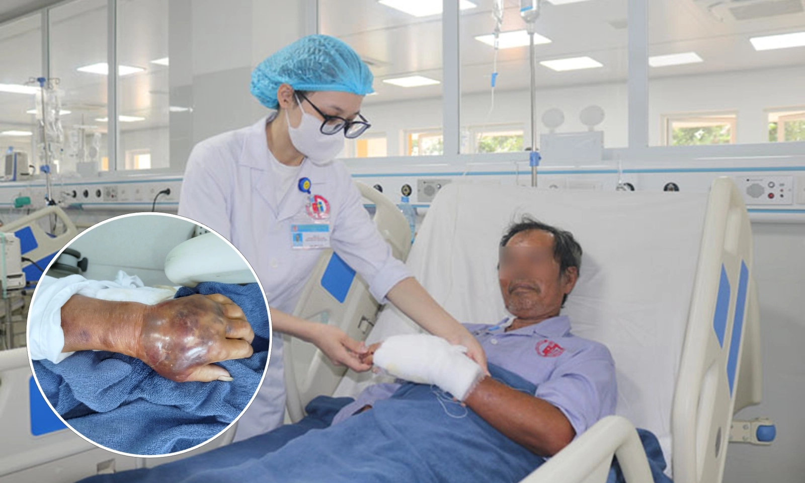 Người đàn ông nhiễm vi khuẩn “ăn thịt người” sau khi bị mảnh tôn cứa vào tay