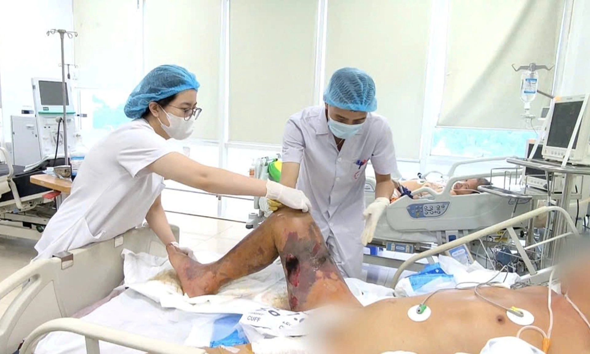 Suýt mất mạng chỉ vì một vết gai đâm vào đùi