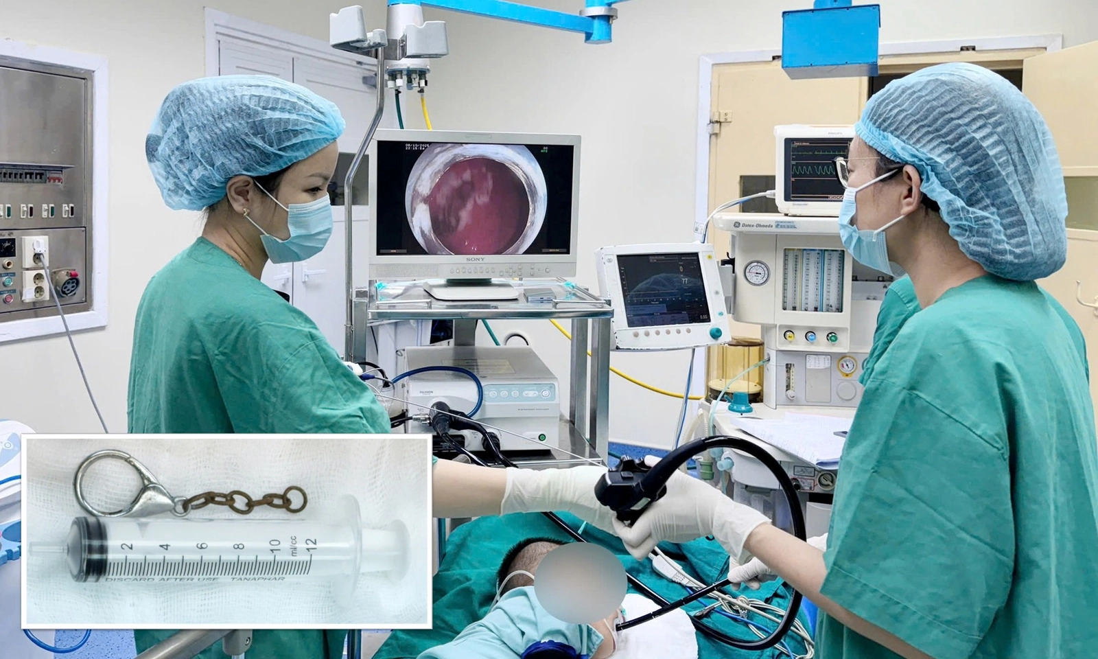 Cứu bé trai vô tình nuốt móc khóa vào bụng