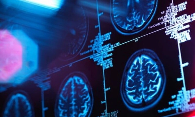 Từ sơ sinh đến tuổi già: Bản đồ 5 giai đoạn phát triển của não người