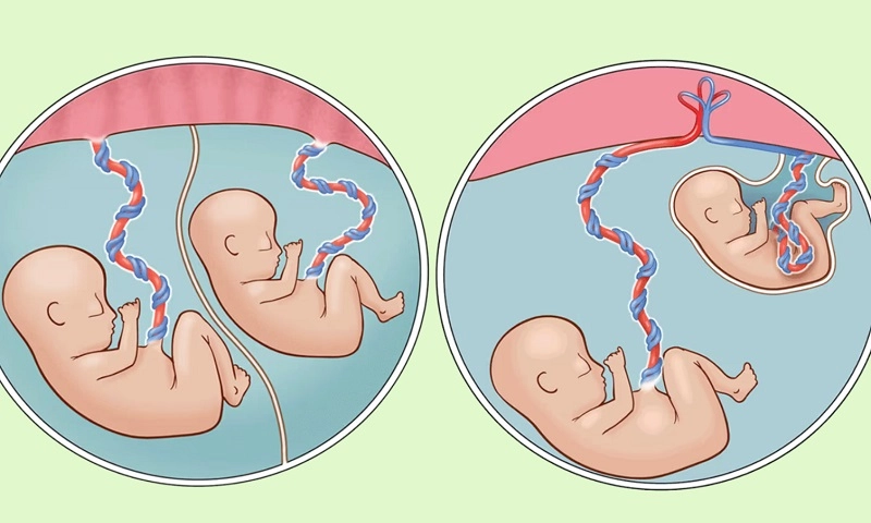 Cứu sống bé trai sinh non nặng chưa tới 1kg