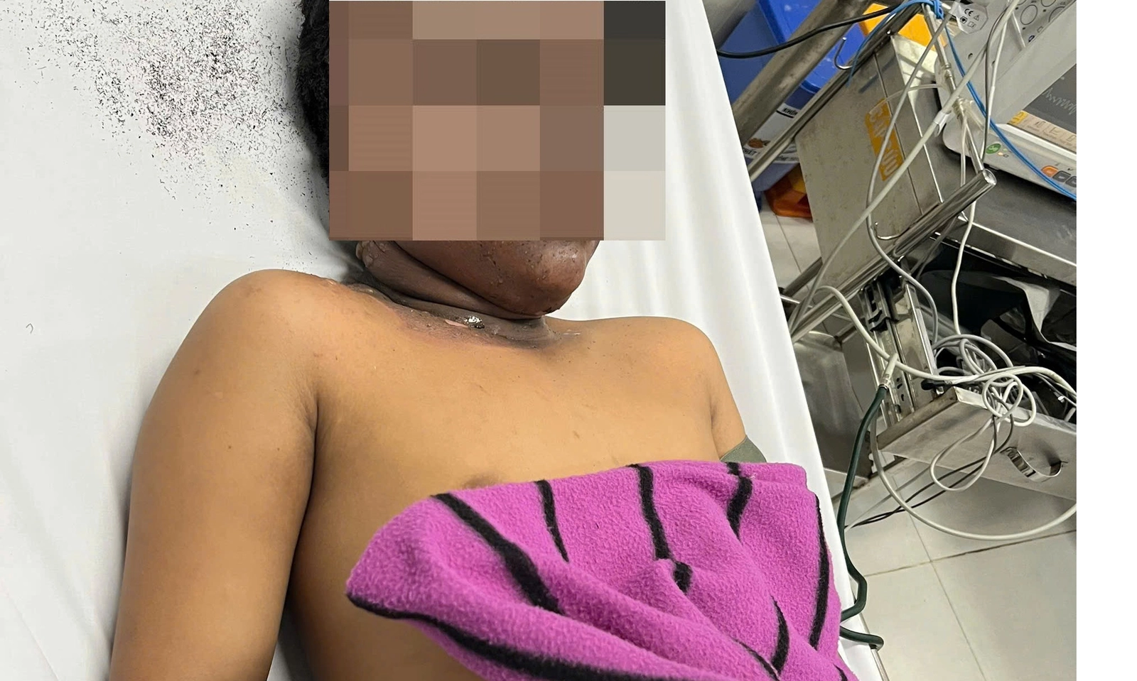 Cảnh báo nguy hiểm từ pháo tự chế ở trẻ em