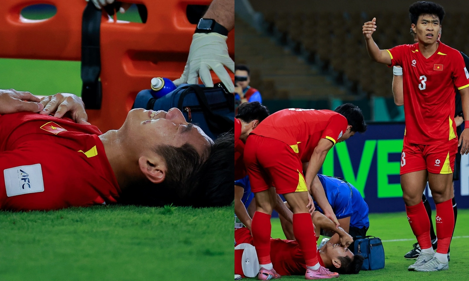 Kết quả chính thức chấn thương nghiêm trọng của Hiểu Minh