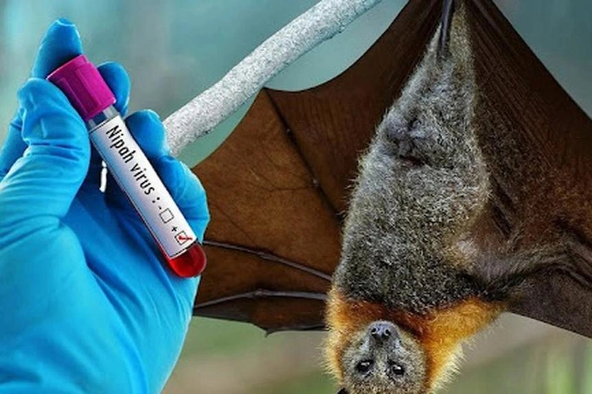 Bác sĩ nhận định về nguy cơ lây lan thành dịch của virus Nipah