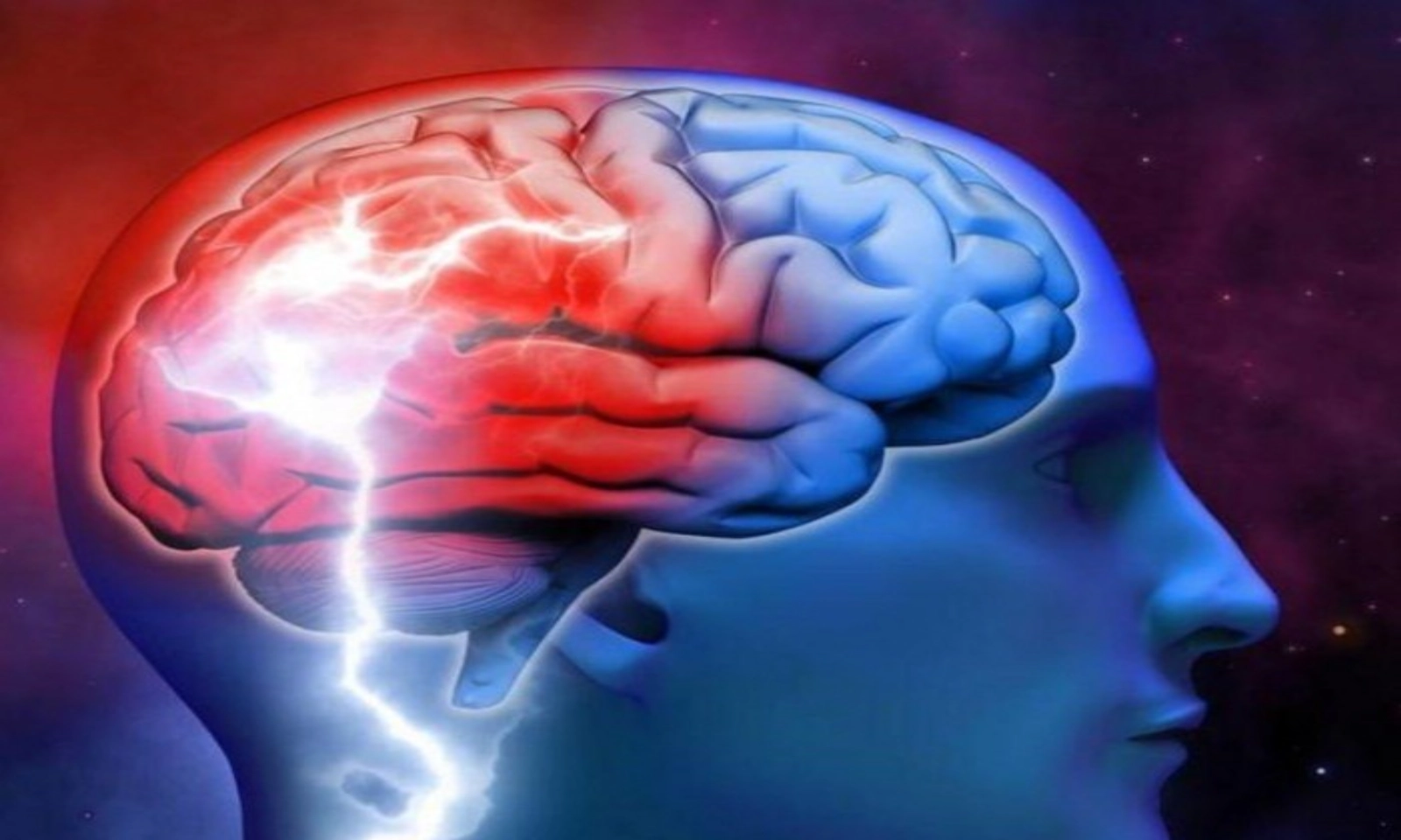 Phòng ngừa nhồi máu não bằng lối sống lành mạnh