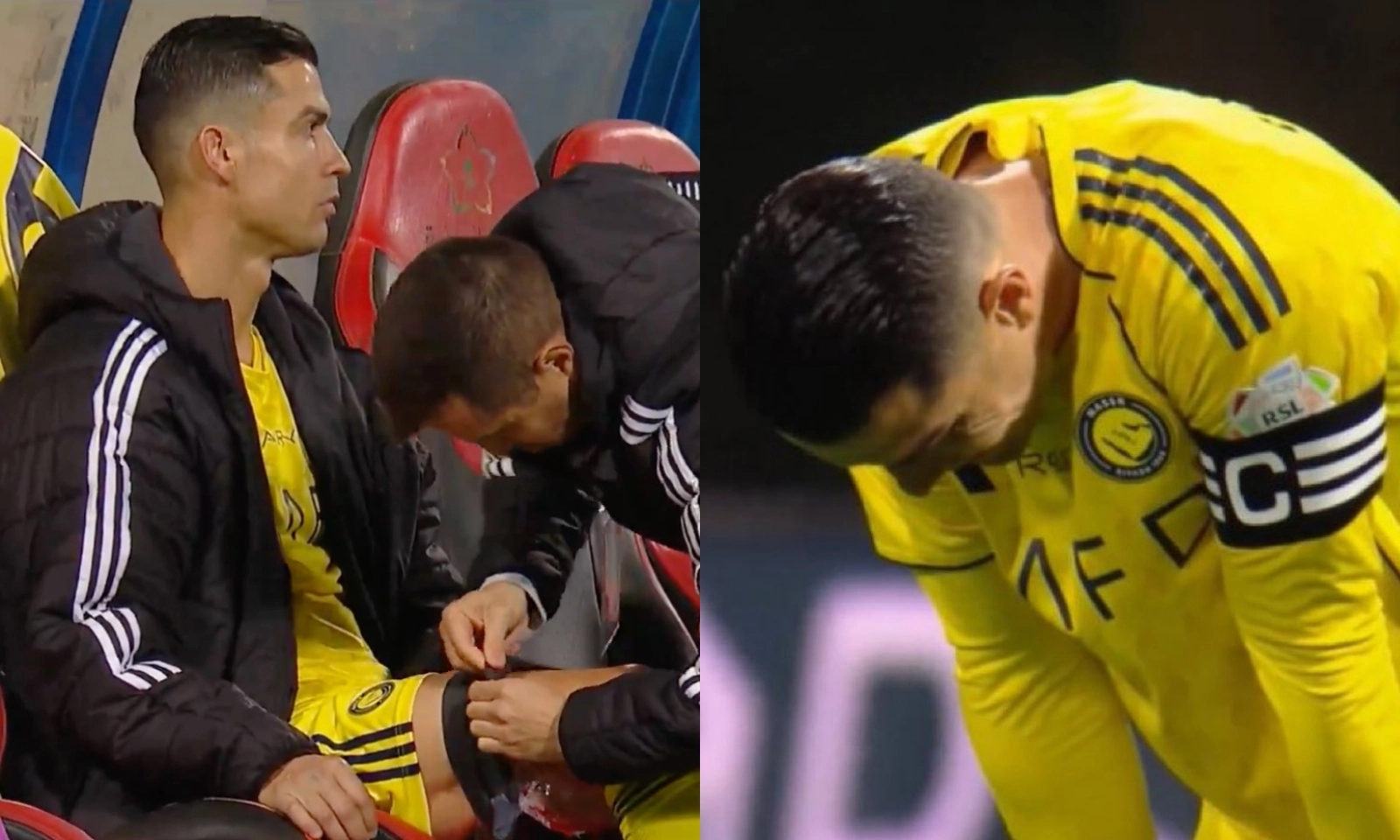 Ronaldo sút hỏng penalty và dính chấn thương đáng lo