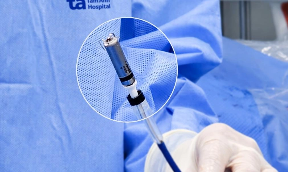 Bệnh viện Tâm Anh cấy máy tạo nhịp tim không dây thế hệ mới