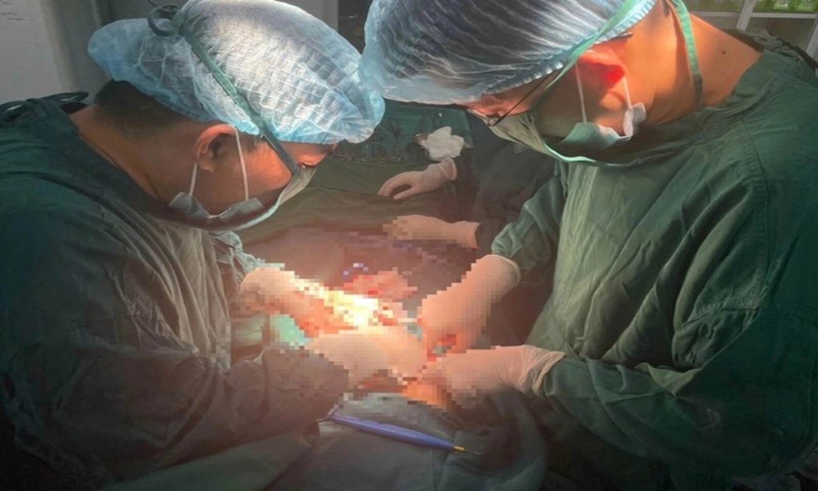 Cứu sống thai phụ 28 tuần bị xoắn u nang buồng trứng hoại tử nguy kịch