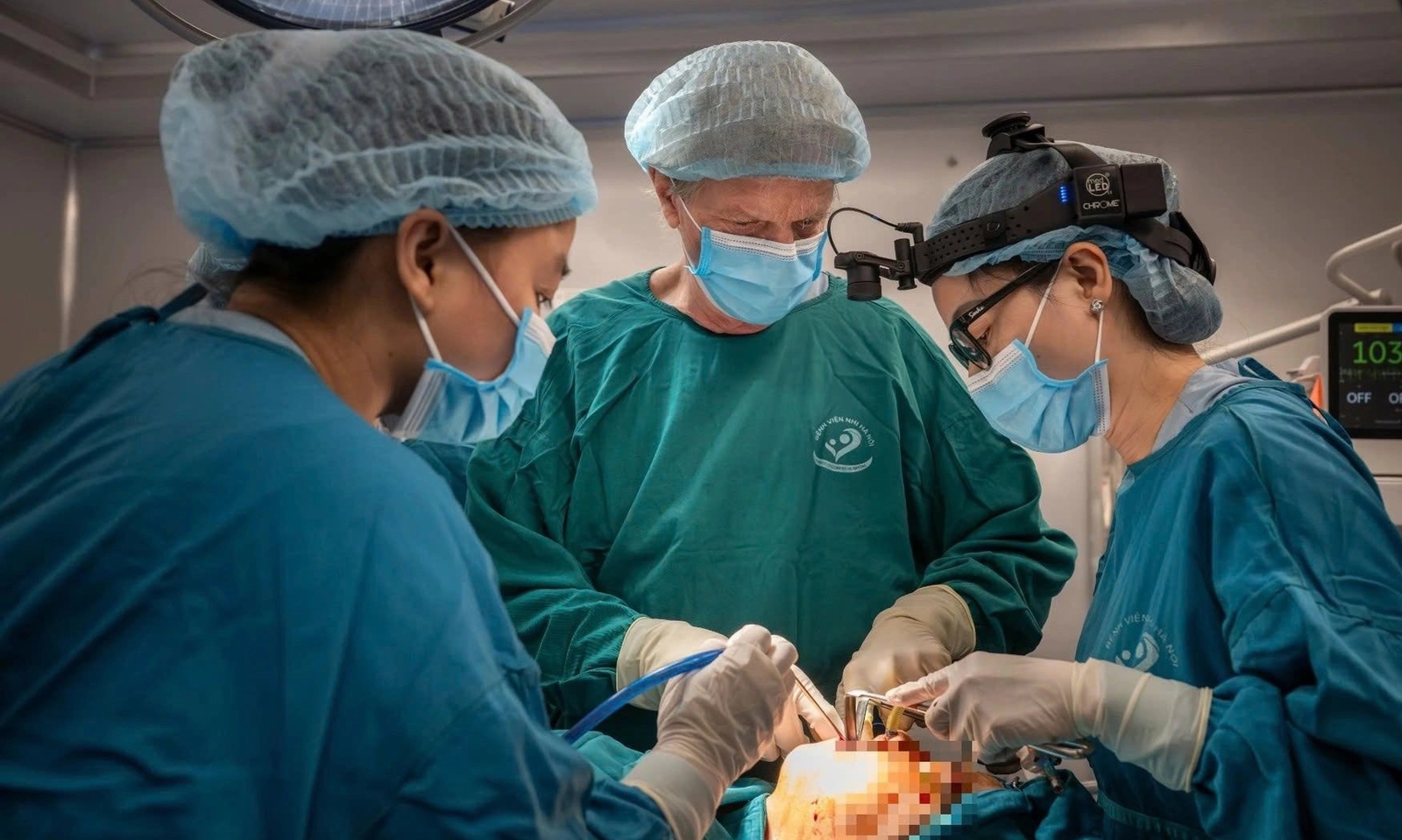 Ca phẫu thuật liên kết Việt – Mỹ giúp tái tạo gương mặt bệnh nhi