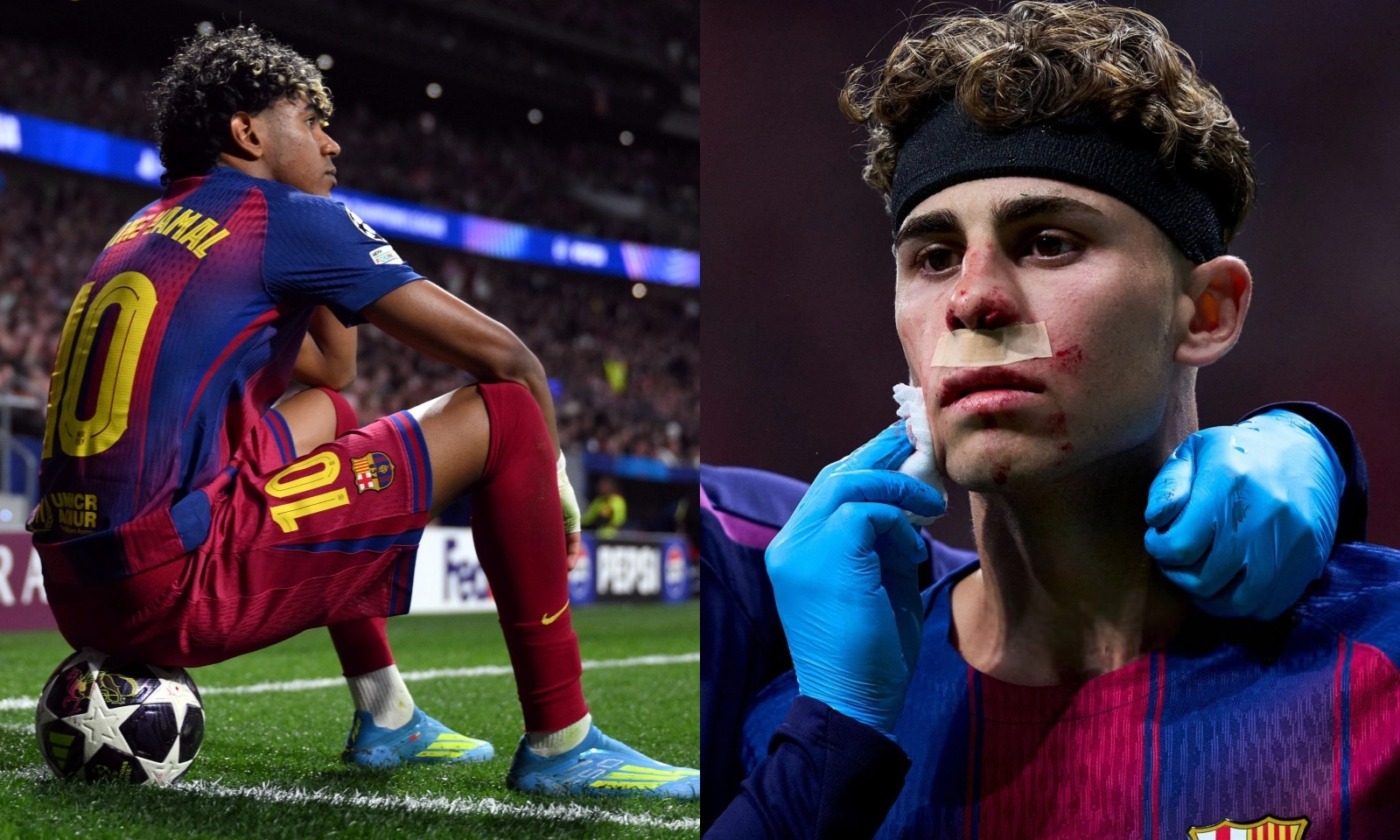 Yamal thản nhiên ngồi tạo dáng, nhìn đồng đội bị đạp vào mặt đổ máu