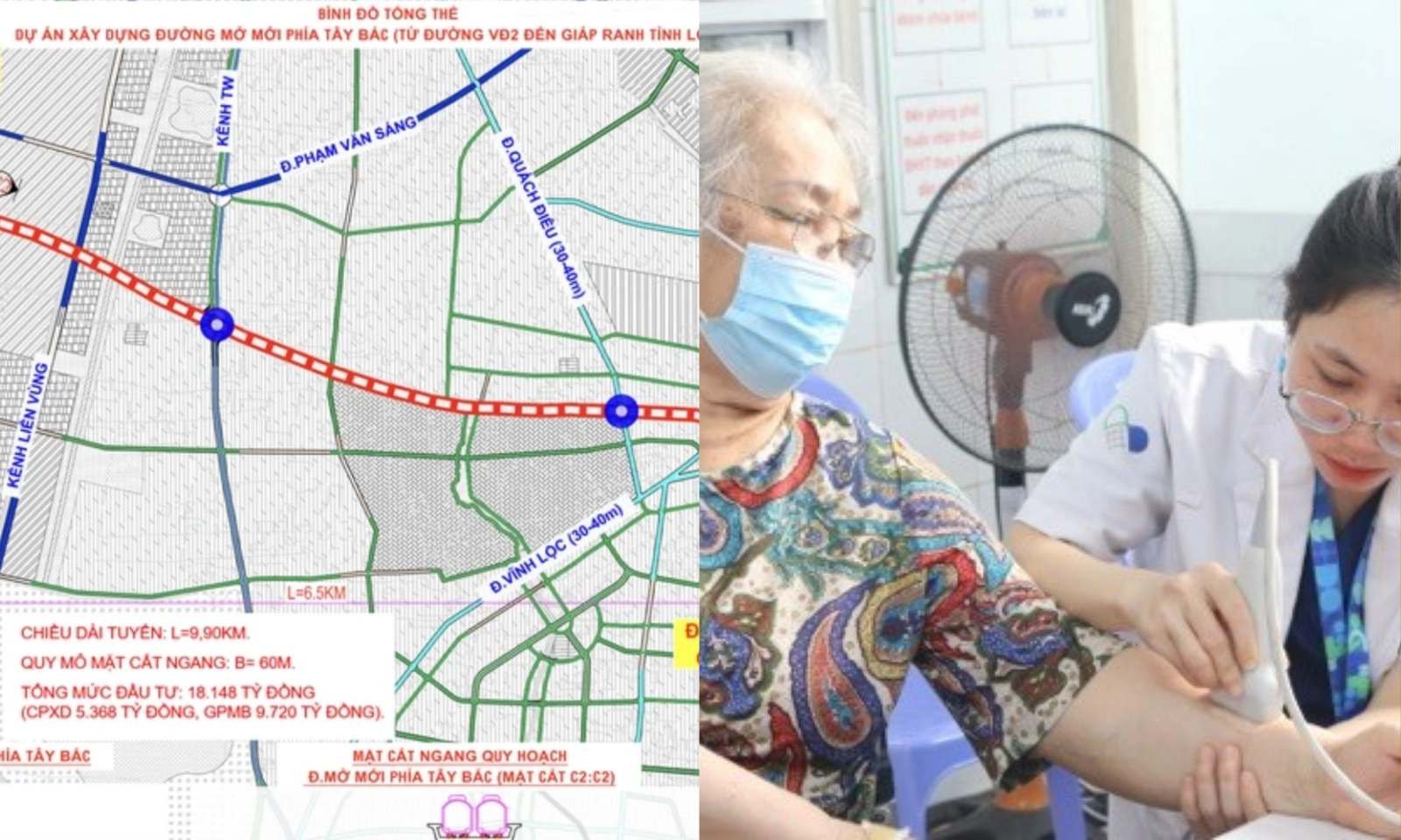 Điểm tin trưa 17/4: Khám sức khỏe miễn phí tại TPHCM | Dự án đường thẳng nối TPHCM đi Tây Ninh