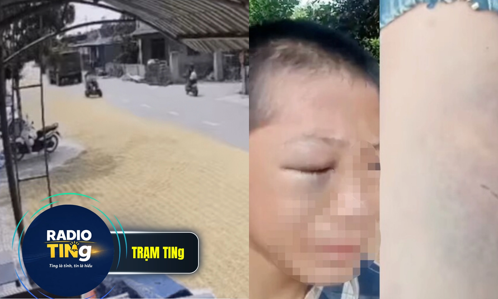 Điểm tin chiều 13/5: Cảnh báo việc phơi thóc lúa trên đường | Bé trai nghi bị bố và mẹ kế bạo hành