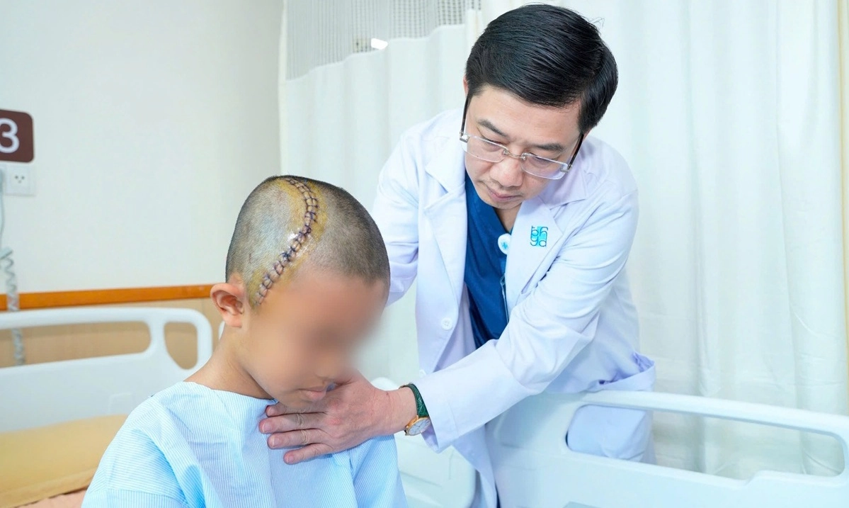 Ca mổ đặc biệt giúp bé 12 tuổi tránh di chứng não