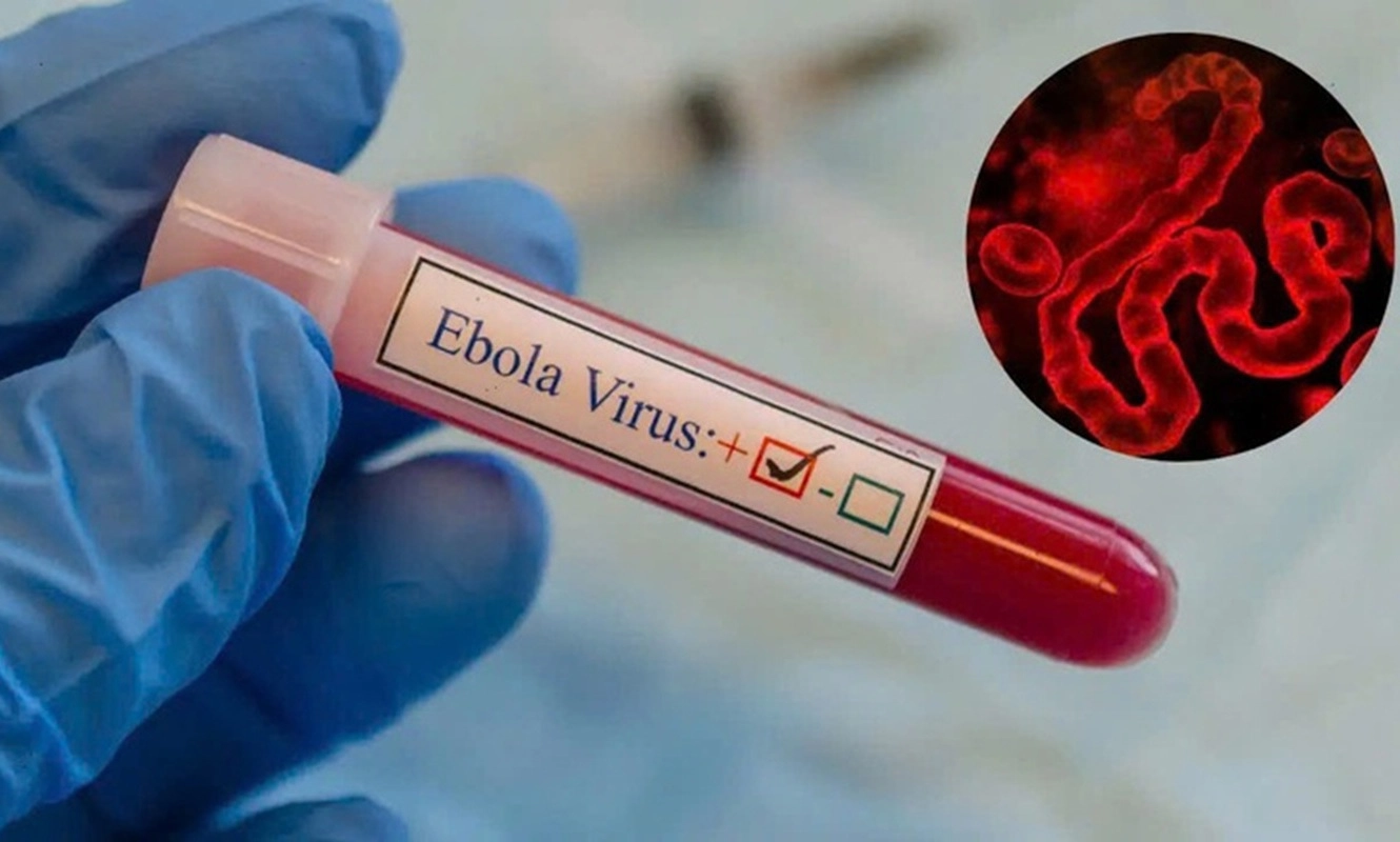 Bộ Y tế kích hoạt giám sát dịch Ebola toàn quốc