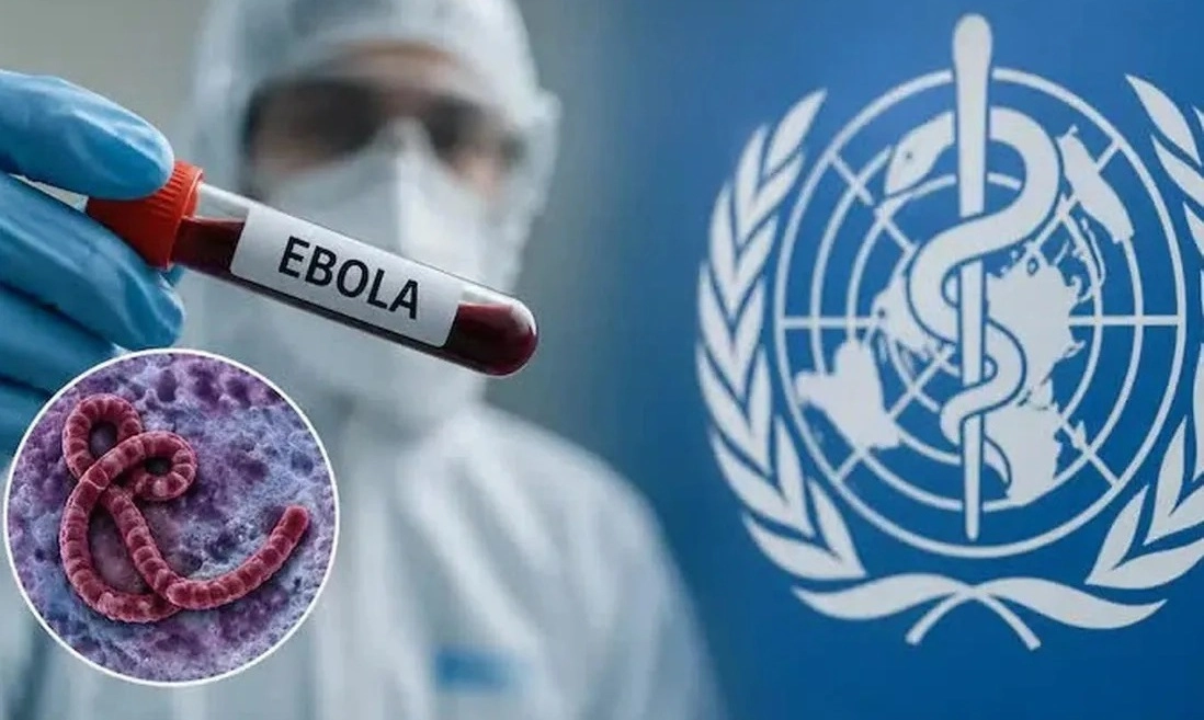 Bộ Y tế ban hành hướng dẫn mới về chẩn đoán, điều trị Ebola