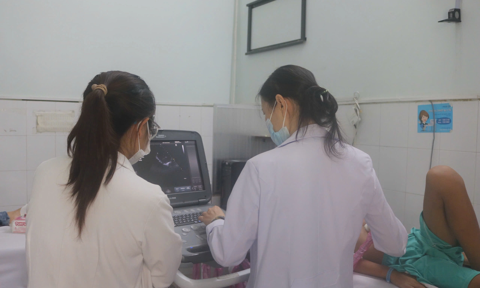 Cứu sống bé trai bị chiếc tăm tre đâm xuyên tim gây tràn mủ màng ngoài tim