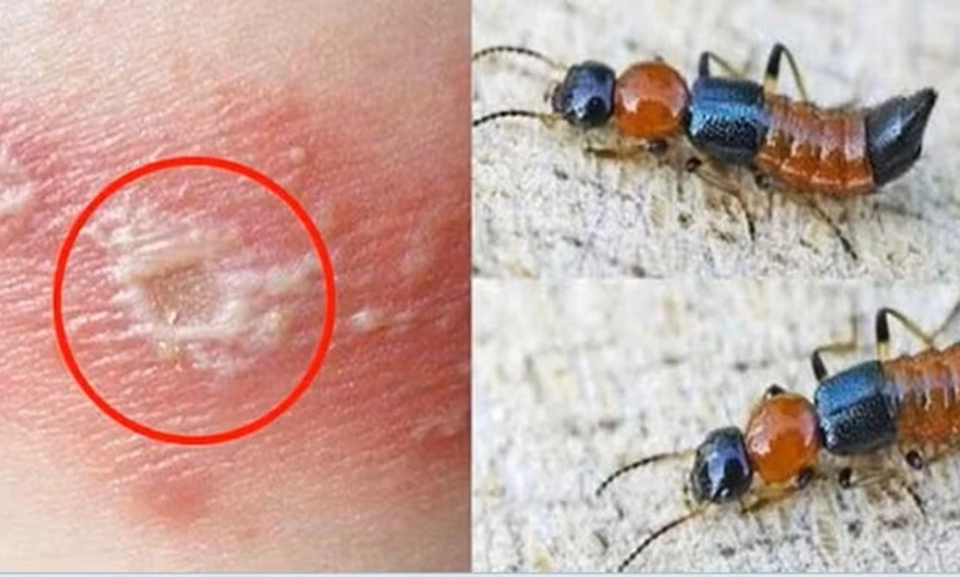Nhận diện đúng kiến ba khoang và zona thần kinh để tránh hậu quả đáng tiếc