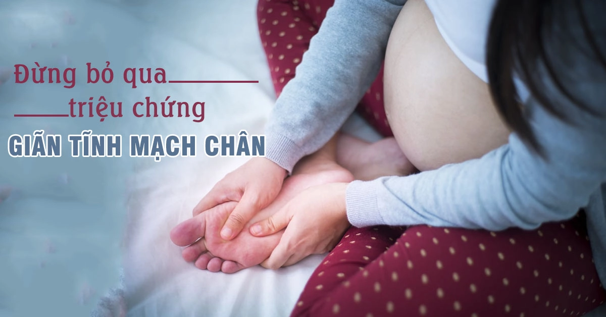 3 dấu hiệu nhận biết bệnh giãn tĩnh mạch chân khi mang thai