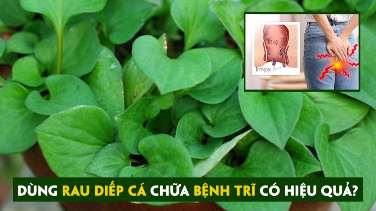 Những cách đẩy lùi bệnh trĩ bằng rau diếp cá nhanh và hiệu quả