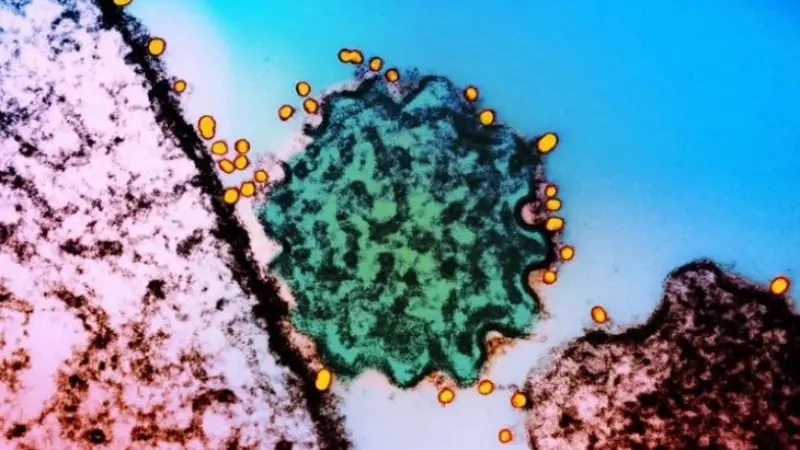 Những điều cần biết về virus Nipah, gây tử vong 40-75%