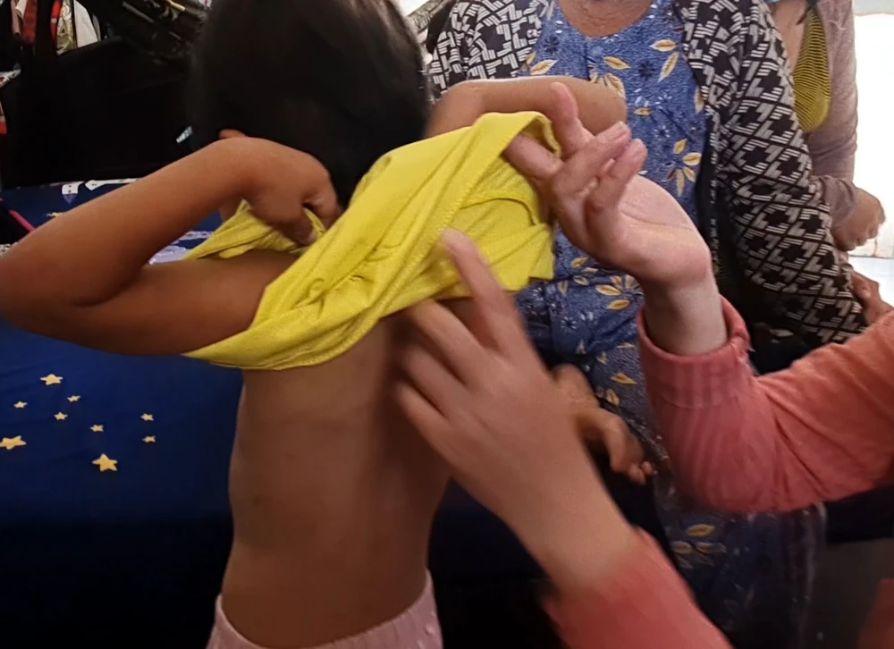 Làm rõ vụ cháu bé 4 tuổi nghi bị cha nuôi đánh