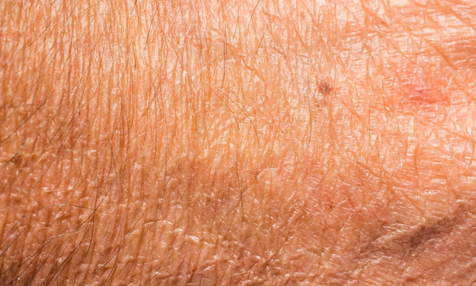 Lý do gây ra nếp nhăn không hẳn do lão hóa